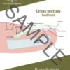 Cross section Nail Unit A4 Poster ENG 1
