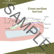 Cross section Nail Unit A4 Poster ENG 1