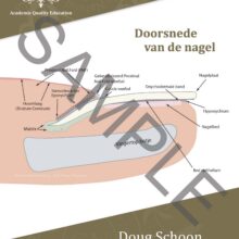 Doorsnede van de nagel  A4 Poster NL 1